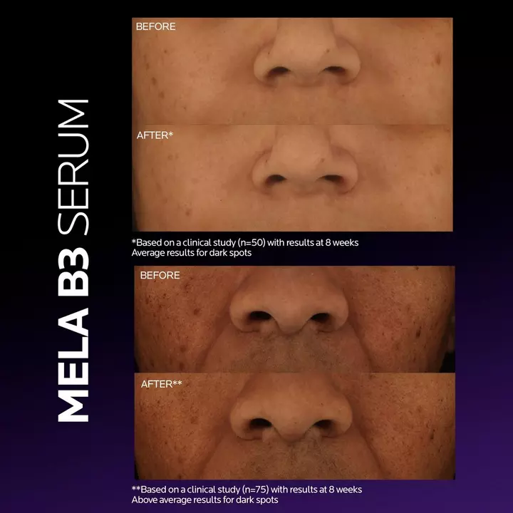 La Roche Posay Mela B3 Serum Ultra Concentrado X 30Ml. - Imagen 3