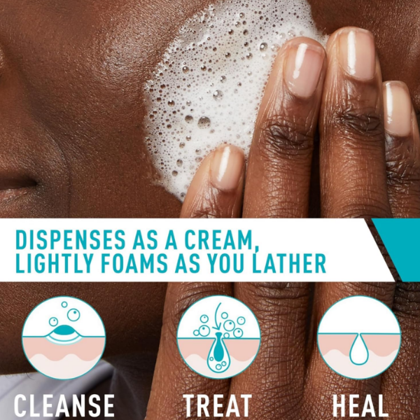 Cera-Ve Limpiador Para Acne En Crema Espumoso 150Ml - Imagen 3